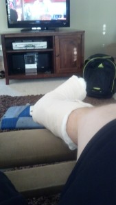 My new fashion accessory for the next two weeks. 